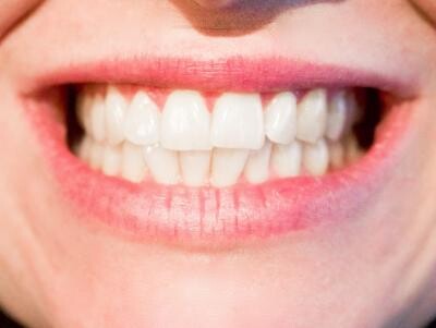 Ştiai că-ţi poţi albi dinţii cu usturoi? / Foto: Pxhere