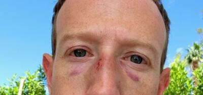 Mark Zuckerberg s-a fotografiat BĂTUT! Ce a pățit fondatorul Facebook/Instagram